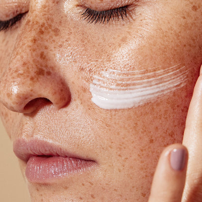 Close-up of a person's face with freckles, showing a swipe of white cream applied to the cheek and a finger touching the side of the face.
